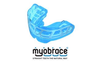 myobrace